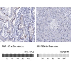 RNF186 Antibody, Novus Biologicals:Antibodies:Primary Antibodies